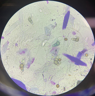 Il microbiota: il nostro alleato invisibile per il benessere olistico